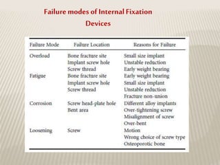 Failuremodes of InternalFixation
Devices
 