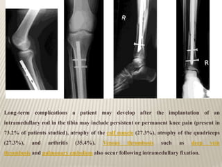Long-term complications a patient may develop after the implantation of an
intramedullary rod in the tibia may include persistent or permanent knee pain (present in
73.2% of patients studied), atrophy of the calf muscle (27.3%), atrophy of the quadriceps
(27.3%), and arthritis (35.4%). Venous thrombosis such as deep vein
thrombosis and pulmonary embolism also occur following intramedullary fixation.
 