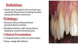 Sharp Linear Defect Tooth hard tissue tooth loss etiology managment and prevention -sana.pptx