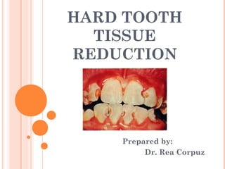 HARD TOOTH
  TISSUE
REDUCTION




    Prepared by:
         Dr. Rea Corpuz
 