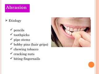 Abrasion

 Etiology

    pencils
    toothpicks
    pipe stems
    bobby pins (hair grips)
    chewing tobacco
    ...