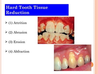 Hard Tooth Tissue
Reduction

 (1) Attrition

 (2) Abrasion

 (3) Erosion

 (4) Abfraction
 