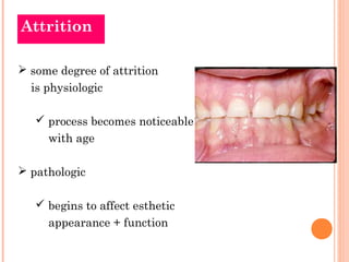 Attrition

 some degree of attrition
  is physiologic

    process becomes noticeable
     with age

 pathologic

    ...