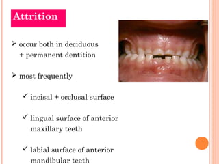 Attrition

 occur both in deciduous
  + permanent dentition

 most frequently

    incisal + occlusal surface

    lin...