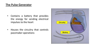Pacemaker Hardware Components of Pacemaker and ICDs - understanding the hardware | PPTX