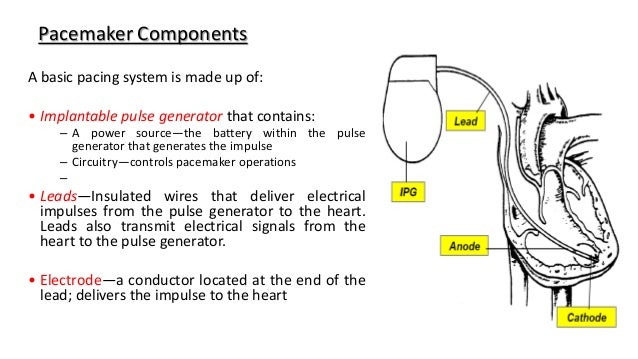 Components of Pacemaker and ICDs - understanding the hardware