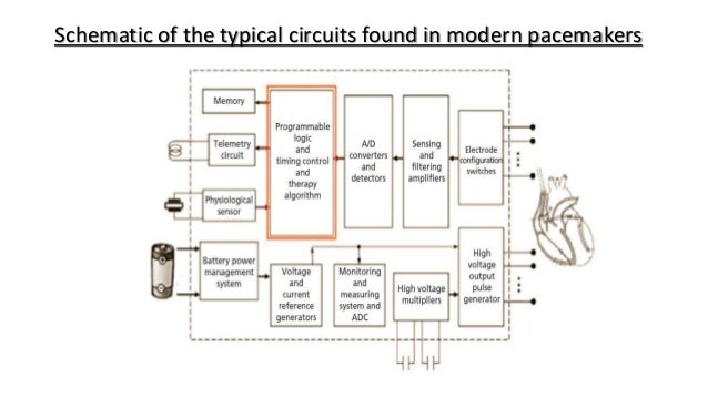 Components Of Pacemaker And ICDs Understanding The Hardware