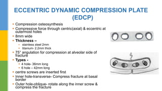 Hardware in maxillofacial trauma | PPTX