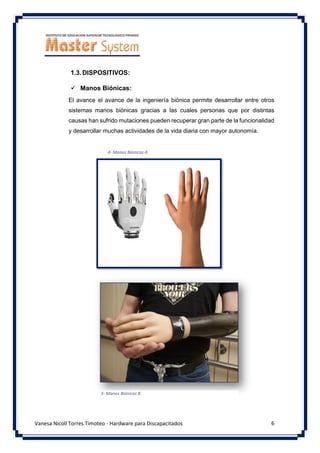 6
Vanesa Nicoll Torres Timoteo - Hardware para Discapacitados
1.3.DISPOSITIVOS:
✓ Manos Biónicas:
El avance el avance de la ingeniería biónica permite desarrollar entre otros
sistemas manos biónicas gracias a las cuales personas que por distintas
causas han sufrido mutaciones pueden recuperar gran parte de la funcionalidad
y desarrollar muchas actividades de la vida diaria con mayor autonomía.
4- Manos Biónicas A
3- Manos Biónicas B
 