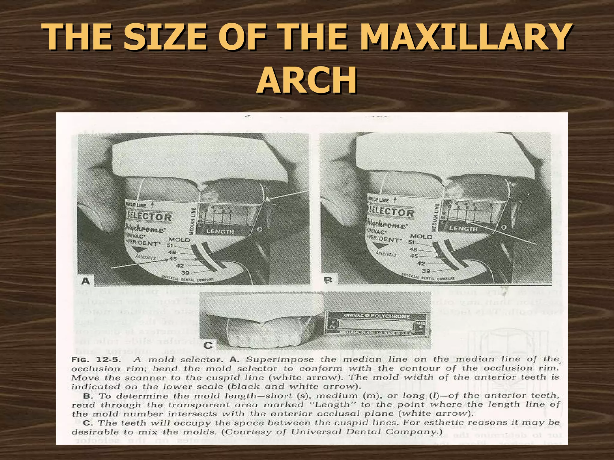 THE SIZE OF THE MAXILLARY ARCH 
