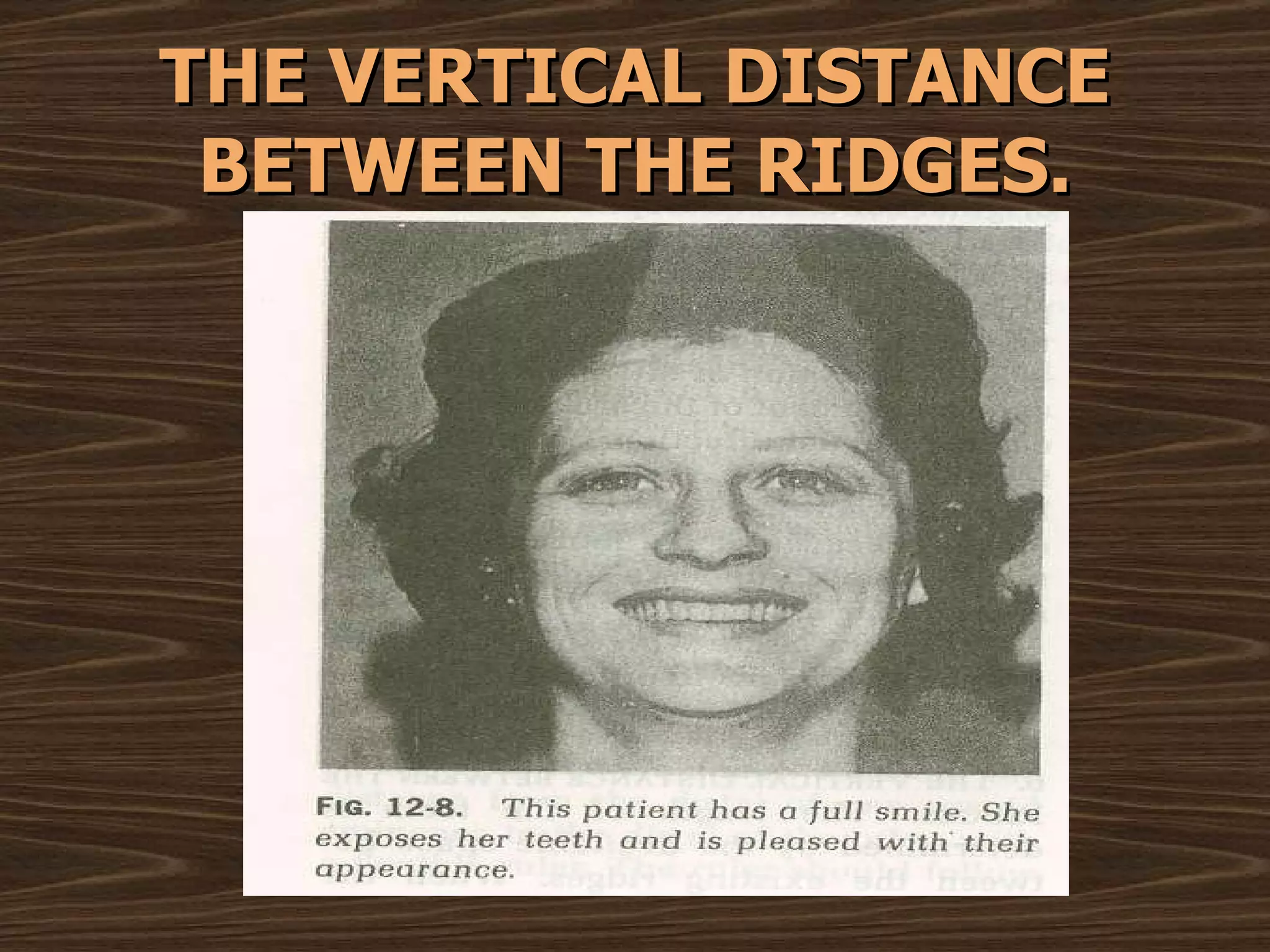 THE VERTICAL DISTANCE BETWEEN THE RIDGES. 