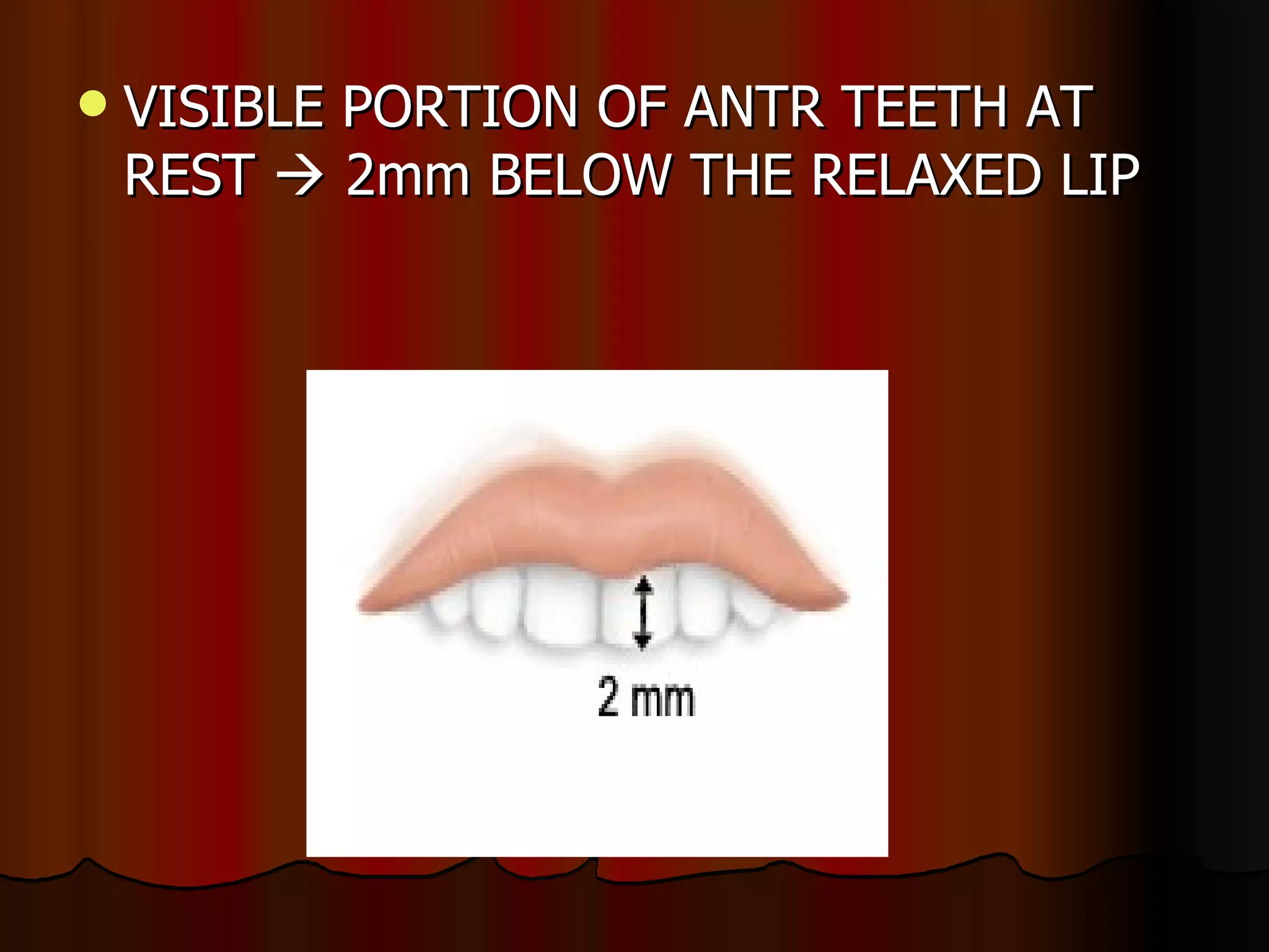 VISIBLE PORTION OF ANTR TEETH AT REST    2mm BELOW THE RELAXED LIP 