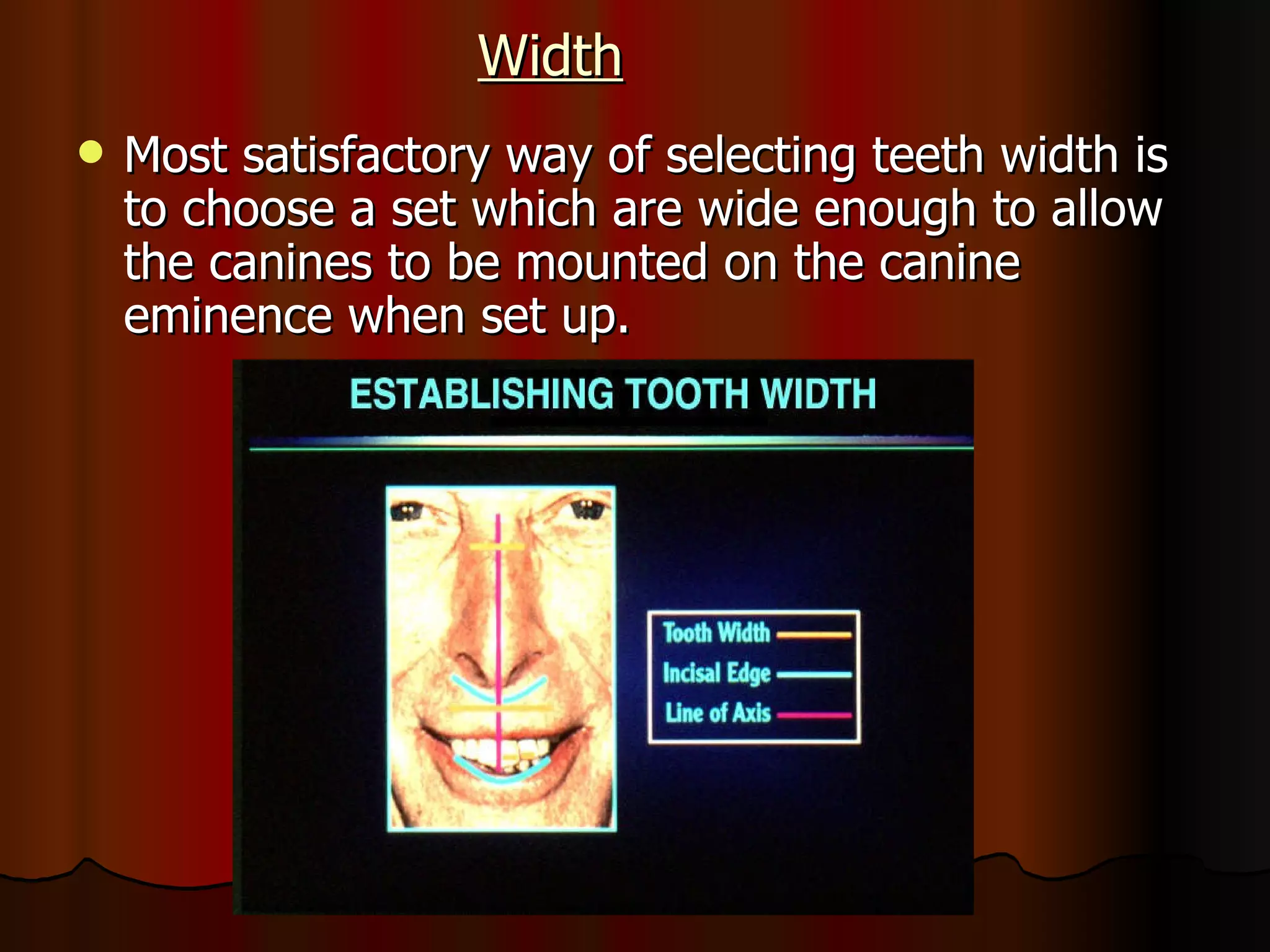 Width Most satisfactory way of selecting teeth width is to choose a set which are wide enough to allow the canines to be mounted on the canine eminence when set up. 