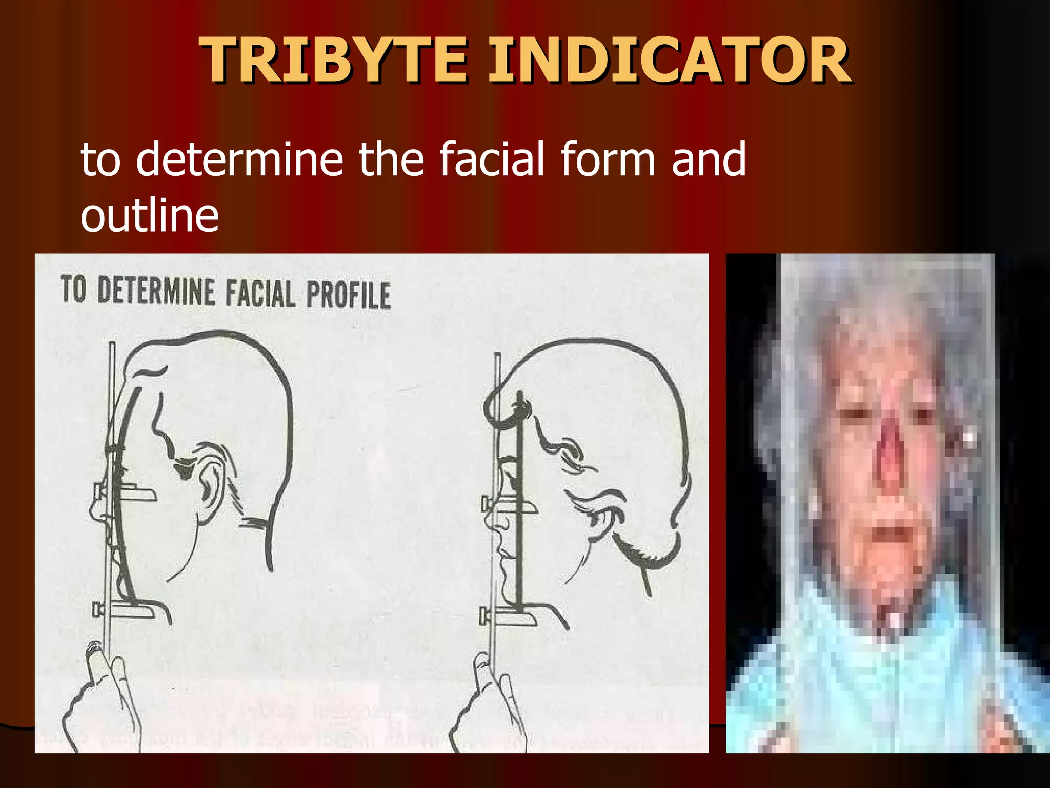 TRIBYTE INDICATOR to determine the facial form and outline 
