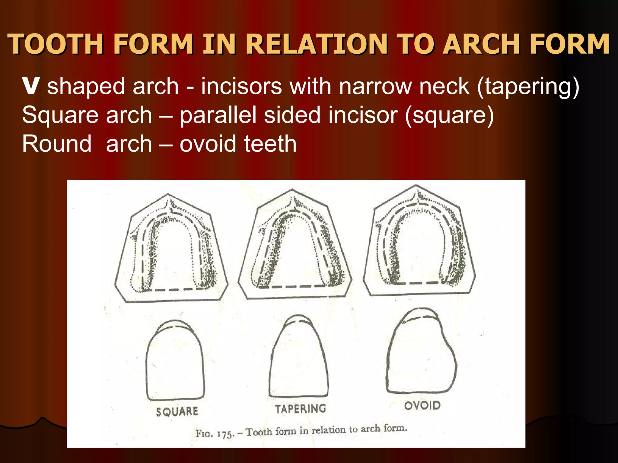 TOOTH FORM IN RELATION TO ARCH FORM V  shaped arch - incisors with narrow neck (tapering) Square arch – parallel sided incisor (square) Round  arch – ovoid teeth  