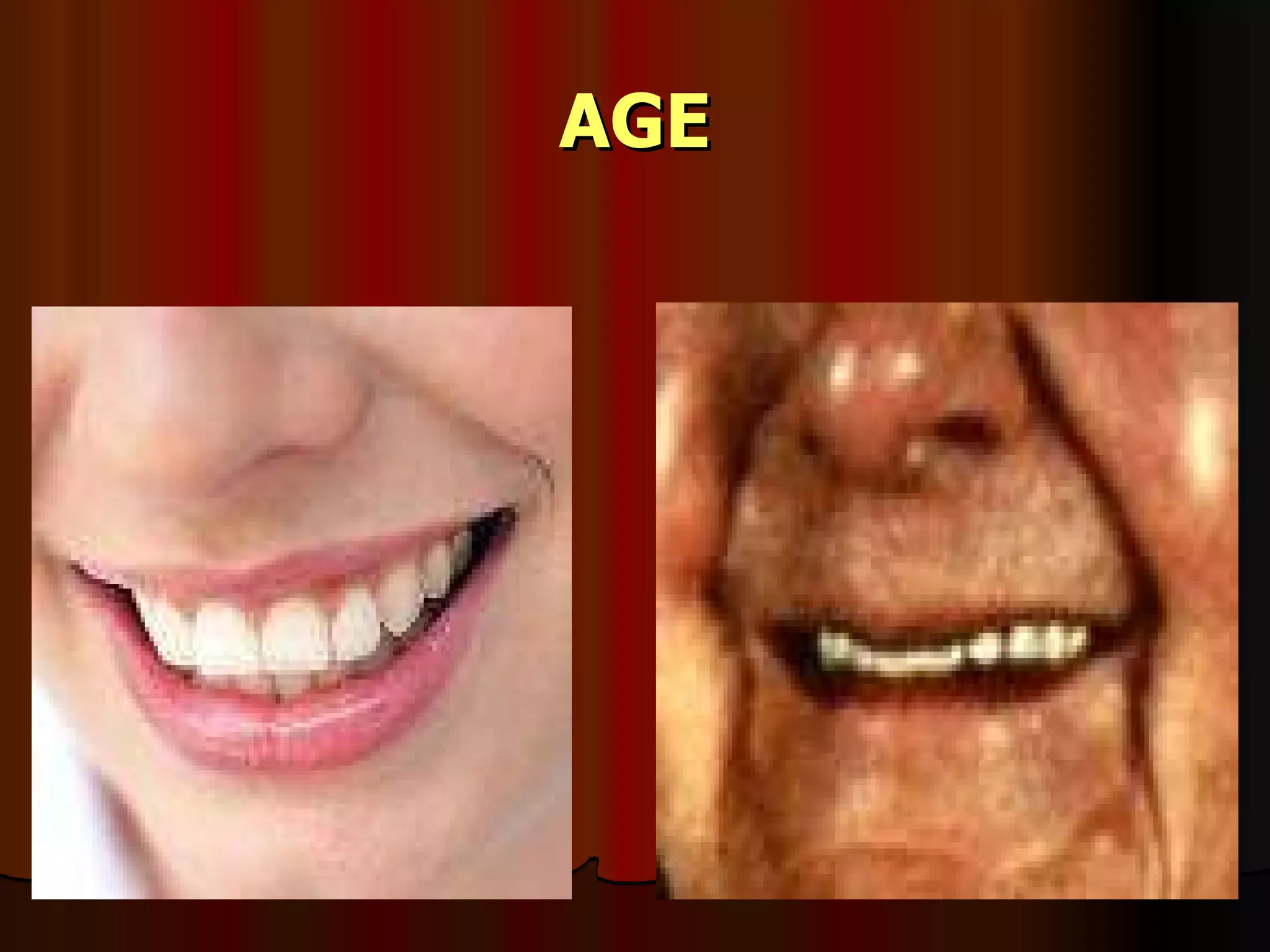 AGE 
