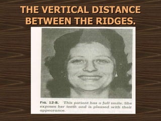 THE VERTICAL DISTANCE BETWEEN THE RIDGES. 