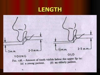 LENGTH 