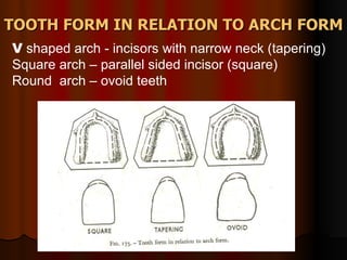 TOOTH FORM IN RELATION TO ARCH FORM V  shaped arch - incisors with narrow neck (tapering) Square arch – parallel sided incisor (square) Round  arch – ovoid teeth  