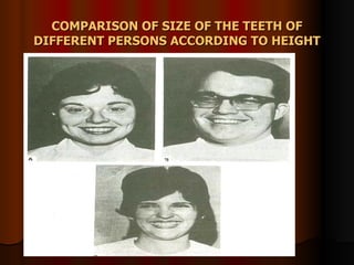 COMPARISON OF SIZE OF THE TEETH OF DIFFERENT PERSONS ACCORDING TO HEIGHT 