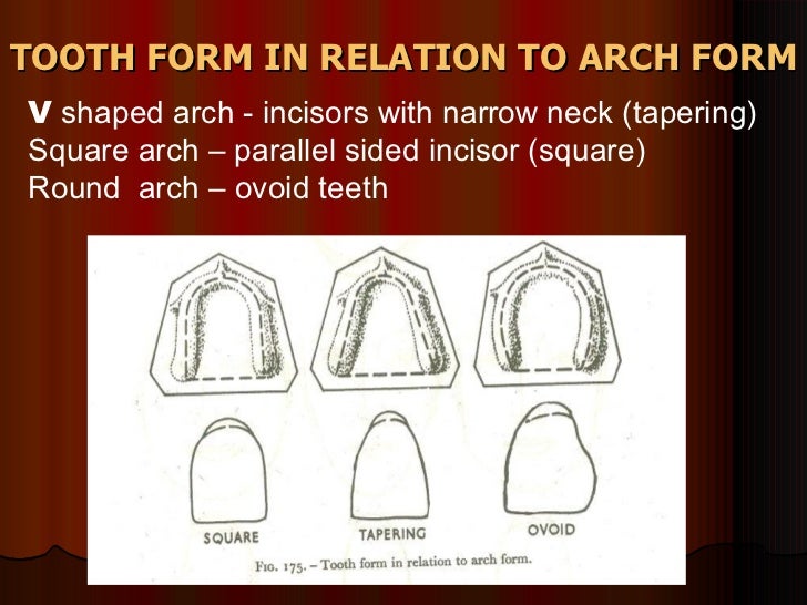 anterior tooth selection