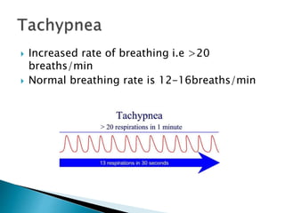 periodic breathing | PPTX