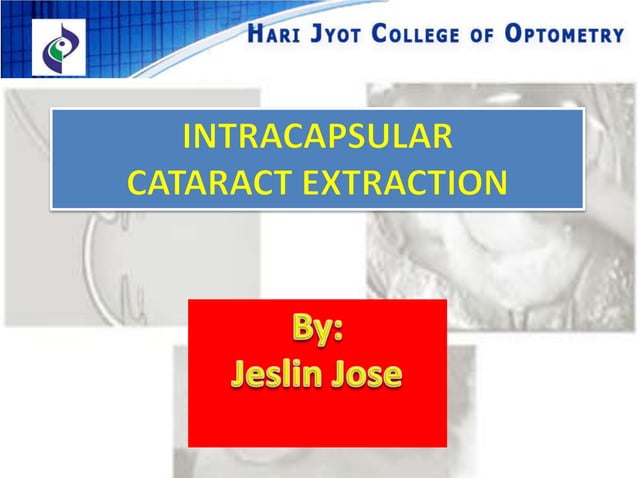 Intracapsular Cataract extraction | PPTX