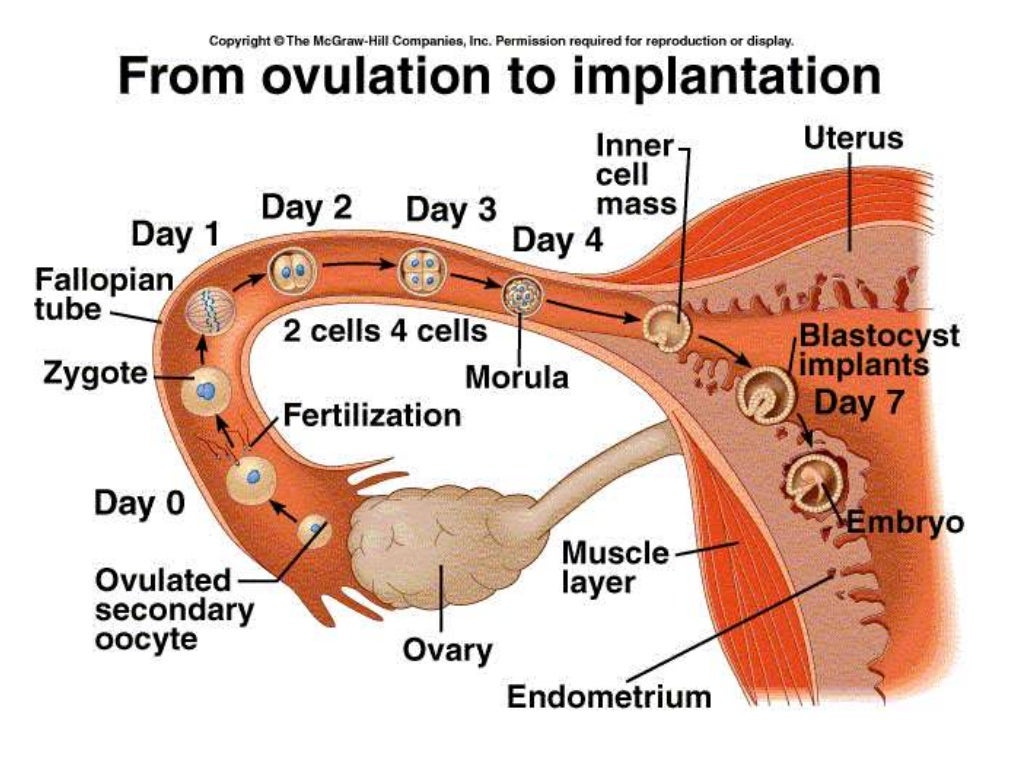 Multiple Pregnancy Diagnosis ,Clinical Features & Complications