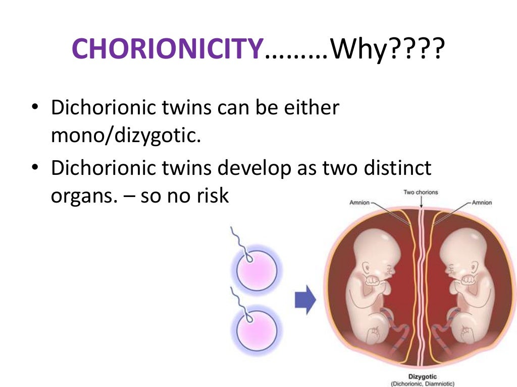 Multiple Pregnancy Diagnosis ,Clinical Features & Complications