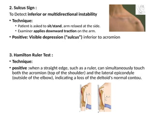 Positive Sulcus Comparative Effectiveness of Immobilization Techniques for Acute ...