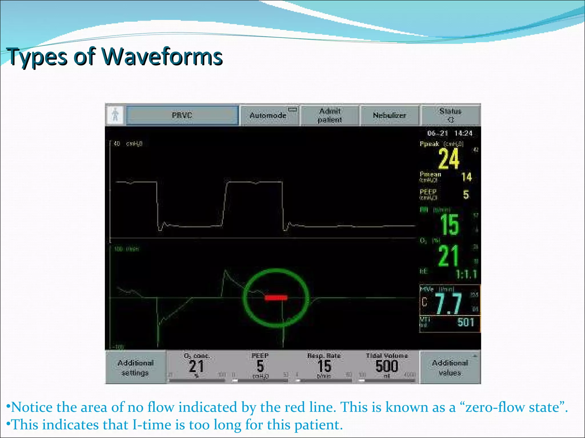 Ventilator Graphics PPT