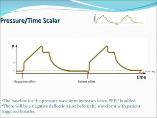 Pressure/Time Scalar The baseline for the pressure waveform increases when PEEP is added. There will be a negative deflection just before the waveform with patient triggered breaths.  5 15 No patient effort Patient effort PEEP  +5 