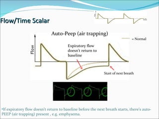 Flow/Time Scalar Auto-Peep (air trapping) If expiratory flow doesn’t return to baseline before the next breath starts, there’s auto-PEEP (air trapping) present , e.g. emphysema. Start of next breath Expiratory flow doesn’t return to baseline = Normal 