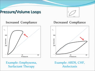 Pressure/Volume Loops 15 30 5 250 500 15 30 5 Increased  Compliance Decreased  Compliance Example: Emphysema, Surfactant Therapy Example: ARDS, CHF, Atelectasis 500 250 