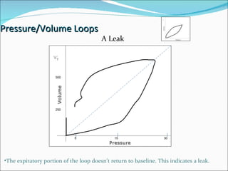 Pressure/Volume Loops 15 30 5 A Leak The expiratory portion of the loop doesn’t return to baseline. This indicates a leak. 500 250 