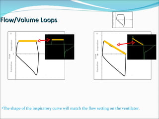Flow/Volume Loops 0 0 The shape of the inspiratory curve will match the flow setting on the ventilator. 