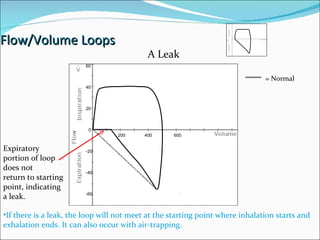 Flow/Volume Loops 0 200 400 600 20 40 60 -20 -40 -60 Expiratory portion of loop does not return to starting point, indicating a leak. A Leak If there is a leak, the loop will not meet at the starting point where inhalation starts and exhalation ends. It can also occur with air-trapping. = Normal 