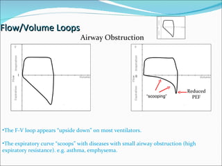 Flow/Volume Loops 0 0 Reduced  PEF “ scooping” The F-V loop appears “upside down” on most ventilators. The expiratory curve “scoops” with diseases with small airway obstruction (high expiratory resistance). e.g. asthma, emphysema. Airway Obstruction 