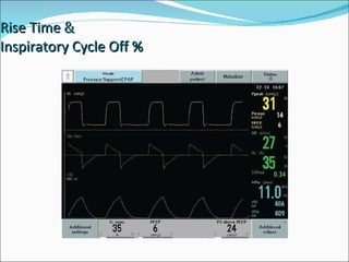 Rise Time  &   Inspiratory Cycle Off % 