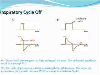 Inspiratory Cycle Off A –The cycle off percentage is too high, cycling off too soon. This makes the breath too small. (not enough Vt.) 60% 10% B – The cycle off percentage is too low, making the breath too long. This forces the patient to actively exhale (increase WOB), creating an exhalation “spike”. Exhalation  spike A B 100% 100% 