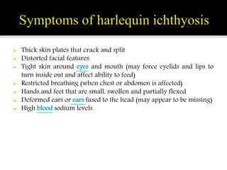 Harlequin Ichthyosis: Causes, symptoms, complications and treatment. | PPT
