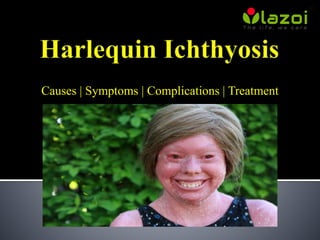 Causes | Symptoms | Complications | Treatment
 