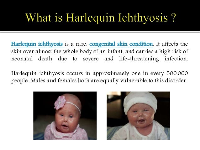 Harlequin Ichthyosis: Causes, symptoms, complications and treatment.
