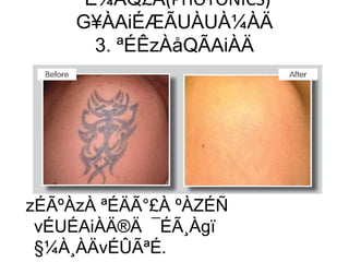 ¨É¼ÀQ£À(PHOTONICS)
G¥ÀAiÉÆÃUÀUÀ¼ÀÄ
3. ªÉÊzÀåQÃAiÀÄ
zÉÃºÀzÀ ªÉÄÃ°£À ºÀZÉÑ
vÉUÉAiÀÄ®Ä ¯ÉÃ¸Àgï
§¼À¸ÀÄvÉÛÃªÉ.
 