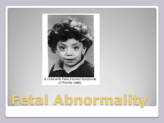 Fetal Abnormality
 