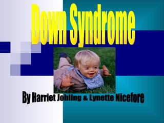 Down Syndrome By Harriet Jobling & Lynette Nicefore 