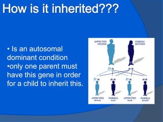 How is it inherited??? Is an autosomal dominant condition