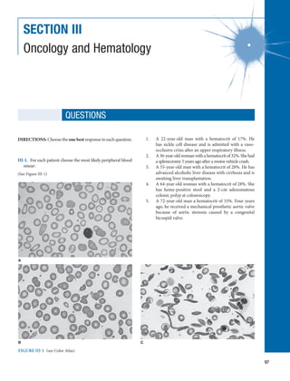 97
SECTION III
Oncology and Hematology
DIRECTIONS: Choose the one best response to each question.
III-1.  For each patient choose the most likely peripheral blood
smear:
(See Figure III-1)
QUESTIONS
A
B C
FIGURE III-1  (see Color Atlas)
1.	 A 22-year-old man with a hematocrit of 17%. He
has sickle cell disease and is admitted with a vaso-­
occlusive crisis after an upper respiratory illness.
2.	 A36-year-oldwomanwithahematocritof32%.Shehad
a splenectomy 5 years ago after a motor vehicle crash.
3.	 A 55-year-old man with a hematocrit of 28%. He has
advanced alcoholic liver disease with cirrhosis and is
awaiting liver transplantation.
4.	 A 64-year-old woman with a hematocrit of 28%. She
has heme-positive stool and a 2-cm adenomatous
colonic polyp at colonoscopy.
5.	 A 72-year-old man a hematocrit of 33%. Four years
ago, he received a mechanical prosthetic aortic valve
because of aortic stenosis caused by a congenital
bicuspid valve.
 