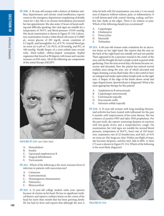 186
SECTION
IV
Infectious
Diseases
IV-210.  A 36-year-old woman with a history of diabetes mel-
litus, hypertension, and chronic renal insufficiency reports
comes to the emergency department complaining of double
vision for 1 day. She is on chronic hemodialysis and missed
her last appointment. She also notes 12 hours of facial swell-
ing and difficulty speaking. Her vital signs are notable for a
temperature of 39.0°C and blood pressure 155/95 mmHg.
Her facial examination is shown in Figure IV-210. Labora-
tory examination reveals a white blood cell count of 15,000/
μL, serum glucose of 205 mg/dL, serum creatinine of
6.3 mg/dL, and hemoglobin A1c of 9.7%. Arterial blood gas
on room air is pH of 7.24, PCO2 of 20 mmHg, and PO2 of
100 mmHg. Needle biopsy of a retro-orbital mass reveals
wide, thick–walled, ribbon-shaped nonseptate hyphal
organisms that branch at 90 degrees with tissue and vascular
invasion on PAS stain. All of the following are ­
components
of the ­
initial therapy EXCEPT:
A.	 Hemodialysis
B.	 Insulin
C.	 Liposomal amphotericin B
D.	 Surgical debridement
E.	 Voriconazole
IV-211.  Which of the following is the most common form of
infection in patients with mucormycosis?
A.	 Cutaneous
B.	 Gastrointestinal
C.	 Hematogenous dissemination
D.	 Pulmonary
E.	 Rhinocerebral
IV-212.  A 21-year-old college student seeks your opinion
because of a lesion on his head. He has no significant medi-
cal history and reports a solitary lesion on the crown of his
head for more than month that has been growing slowly.
He has had no fever and reports that although the area is
itchy, he feels well. On examination, you note a 3-cm round
area of alopecia without redness, pain, or inflammation. It
is well demarcated with central clearing, scaling, and bro-
ken hair shafts at the edges. There is no redness or pain.
Which of the following should you ­
recommend?
A.	 Caspofungin
B.	 Clindamycin
C.	 Doxycycline
D.	 Minoxidil
E.	 Terbinafine
IV-213.  A 68-year-old woman seeks evaluation for an ulcera-
tive lesion on her right hand. She reports that the area on
the back of her right hand was initially red and not painful.
There appeared to be a puncture wound in the center of the
area,andshethoughtshehadasimplescratchacquiredwhile
gardening. Over the next several days, the lesion became ver-
rucous and ulcerated. Now the patient has noticed several
nodular areas along the arm, one of which ulcerated and
began draining a serous fluid today. She is also noted to have
an enlarged and tender epitrochlear lymph node on the right
arm. A biopsy of the edge of the lesion shows ovoid and
cigar-shaped yeasts. Sporotrichosis is diagnosed. What is the
most appropriate therapy for this patient?
A.	 Amphotericin B intravenously
B.	 Caspofungin intravenously
C.	 Clotrimazole topically
D.	 Itraconazole orally
E.	 Selenium sulfide topically
IV-214.  A 35-year-old woman with long-standing rheuma-
toid arthritis has been treated with infliximab for the past
6 months with improvement of her joint disease. She has
a history of positive PPD and takes INH prophylaxis. For
the past week, she reports worsening dyspnea on exertion
with low-grade fevers and a nonproductive cough. On
examination, her vital signs are notable for normal blood
pressure, temperature of 38.0°C, heart rate of 105 beats/
min, respiratory rate of 22 breaths/min, and SaO2 of 91%
on room air. Her lungs are clear. Within one flight of steps,
she becomes dyspneic, and her SaO2 falls to 80%. A chest
CT scan is shown in Figure IV-214. Which of the following
is the most likely diagnosis?
FIGURE IV-210  (see Color Atas)
FIGURE IV-214
 