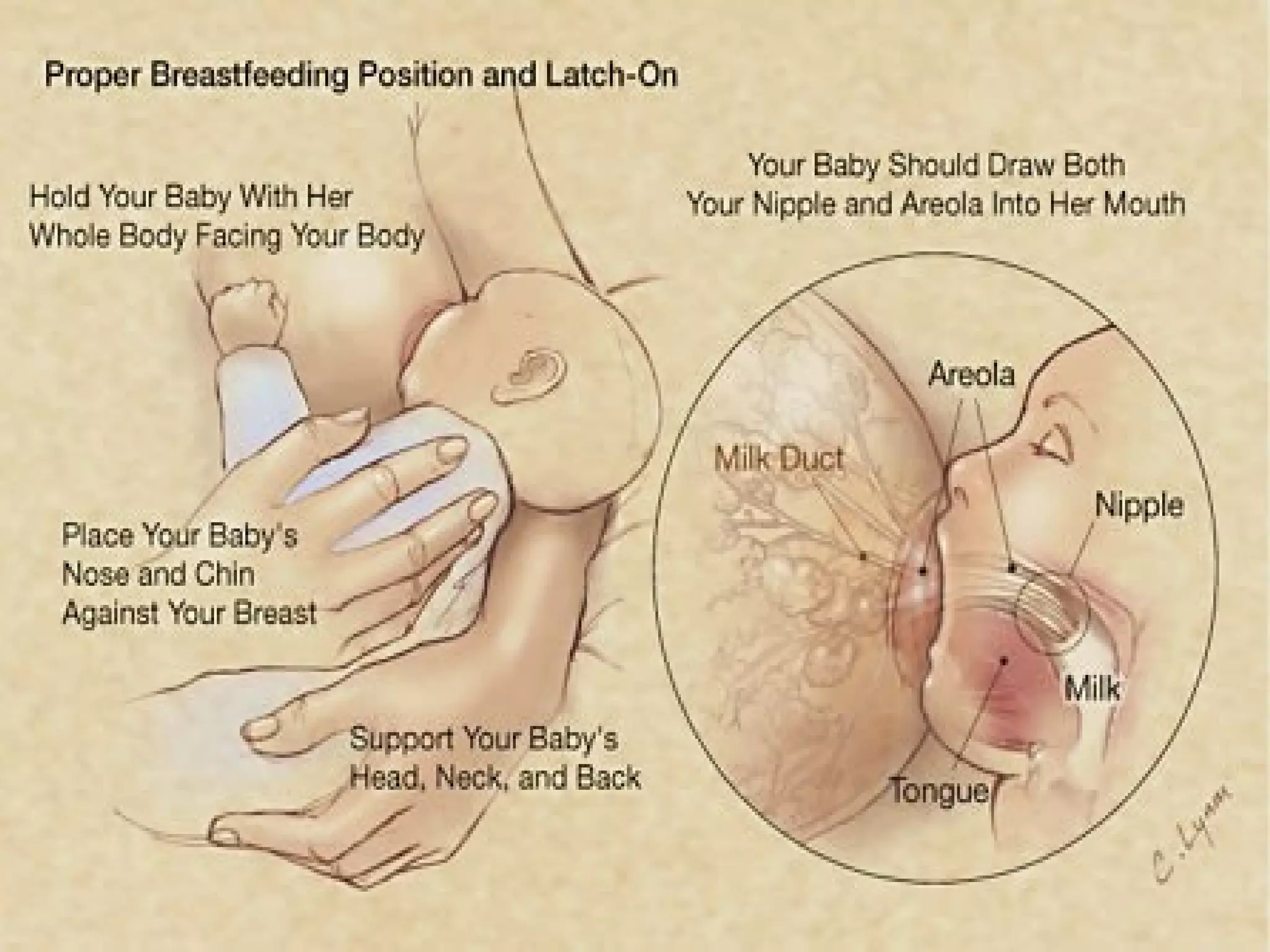 Breast Feeding
• Feeding position
 